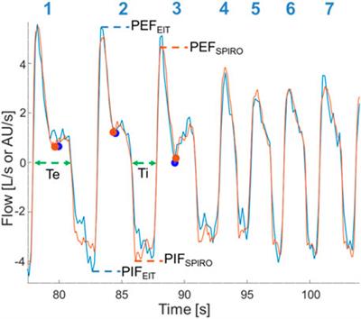 Comparison of electrical impedance tomography and spirometry-based measures of airflow in healthy adult horses